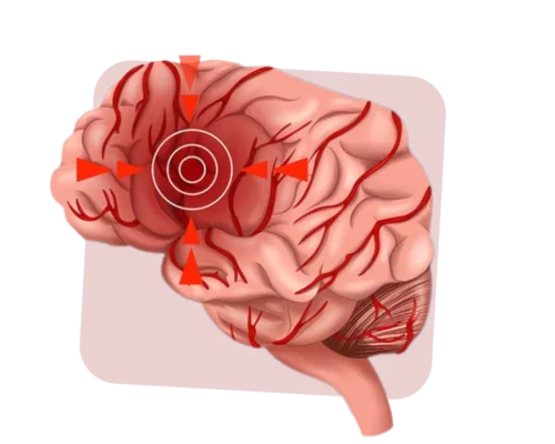 Best rudraksha for managing migraine problemes and stress
